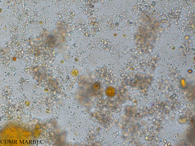 phyto/Pertuis Charentais/Tasdon_st7/PAMPAS 2019-2021/Hariotina reticulata (old Coelastrum reticulatum -TASDON_St7_0419 -6).tif(copy)_thumb.jpg